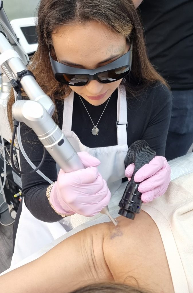 Laser Treatment Business Profits