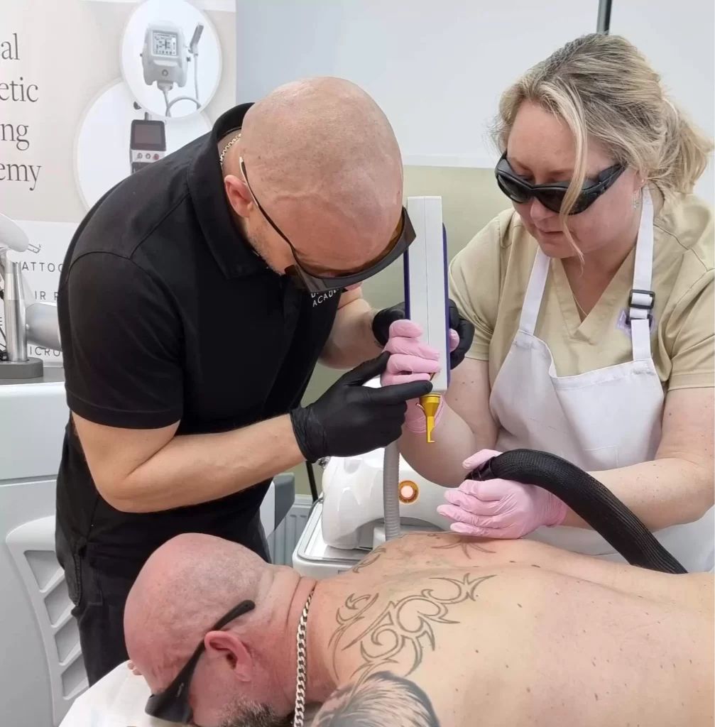 Laser Tattoo Removal
