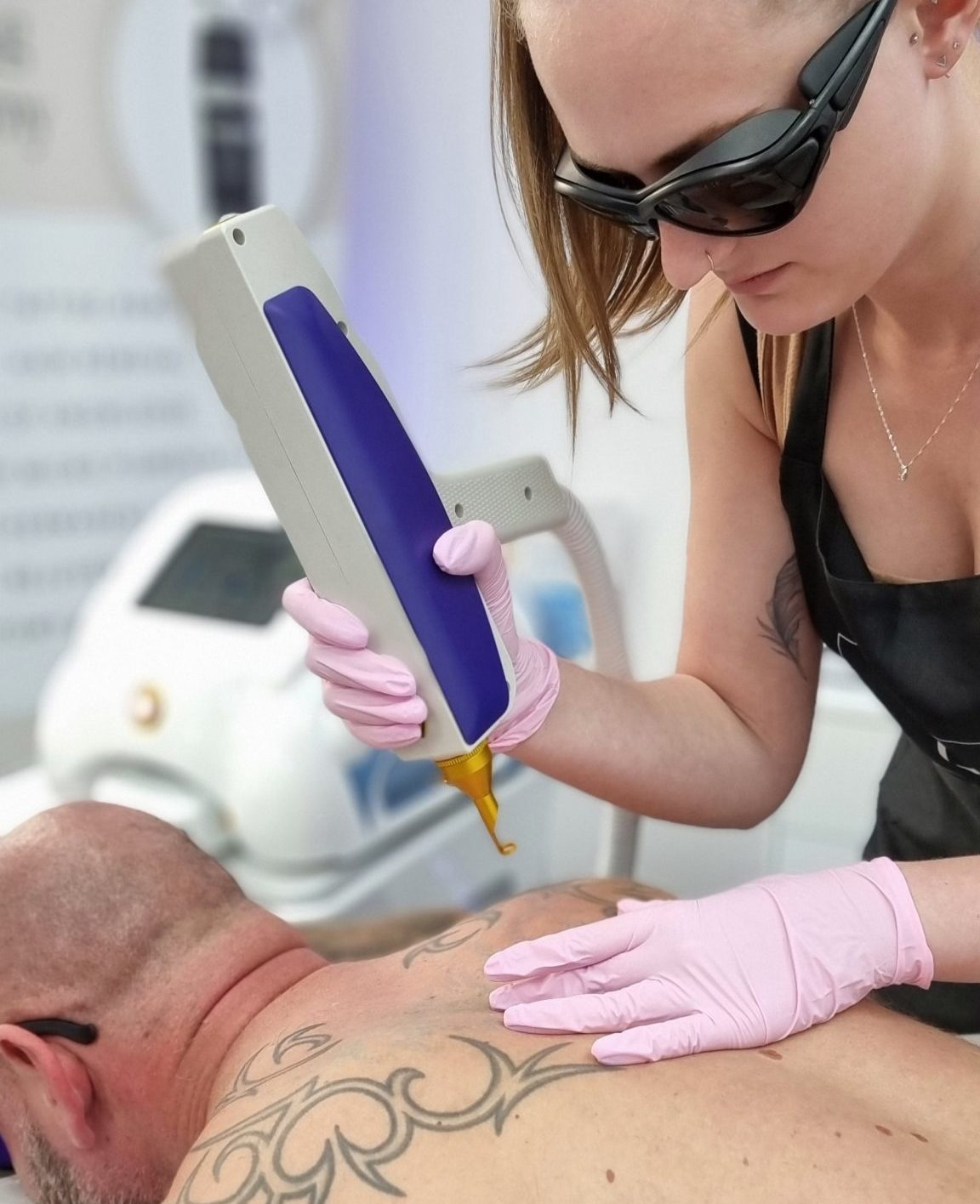 Laser Tattoo Removal