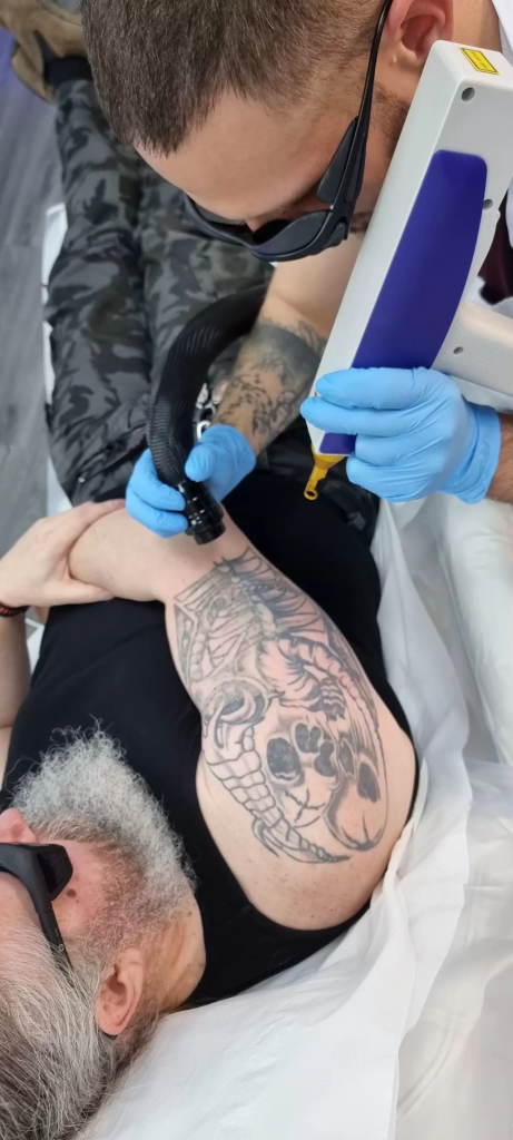 Tattoo Removal Practitioner Salary